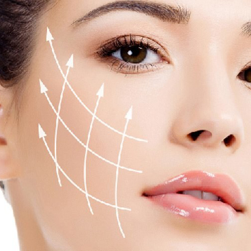 Implantes Faciales