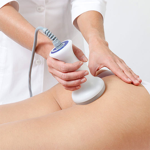 Radiofrecuencia (Tensado de piel y celulitis)